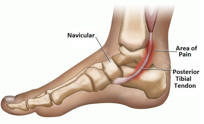 foot4