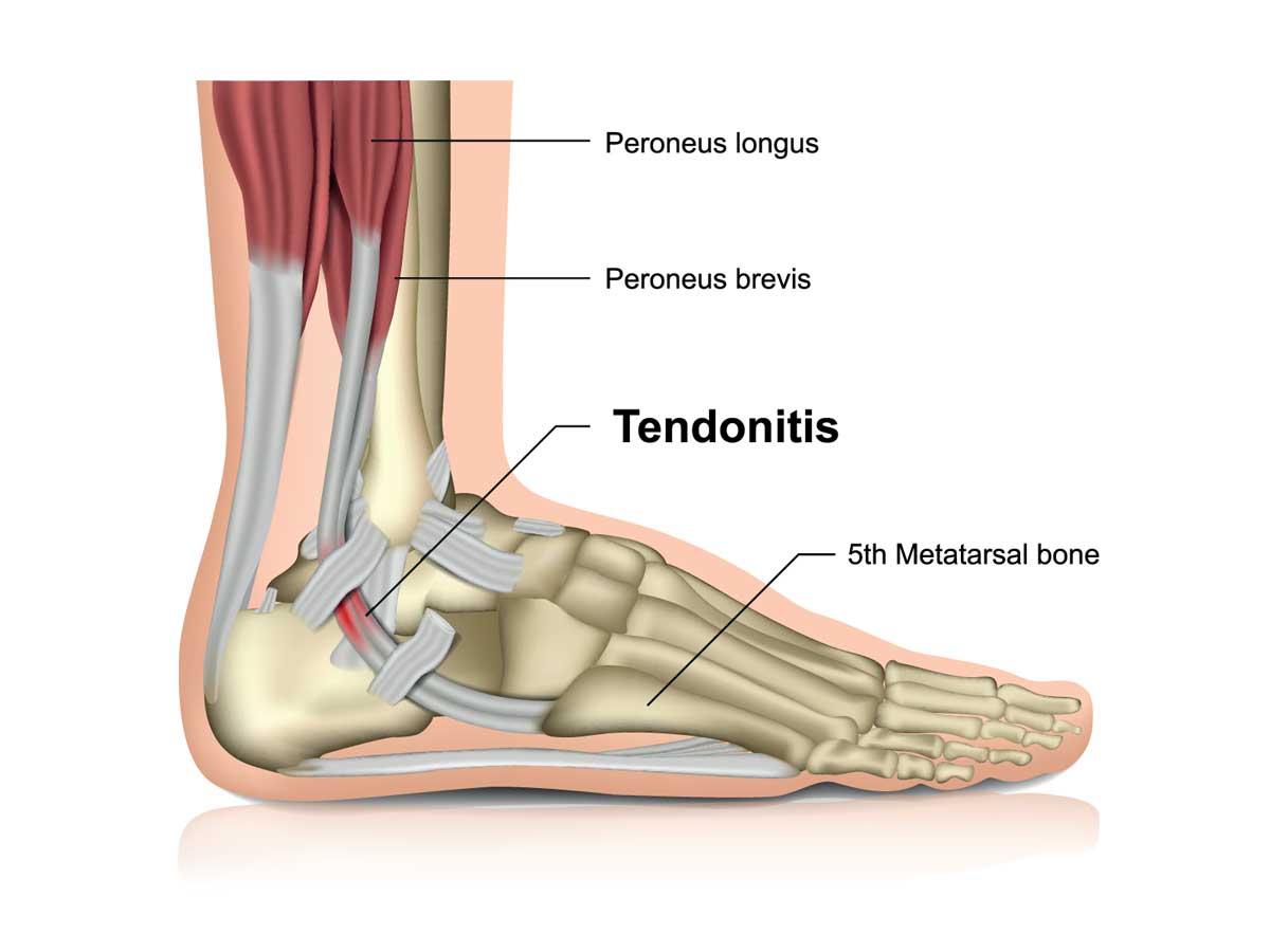 foot5