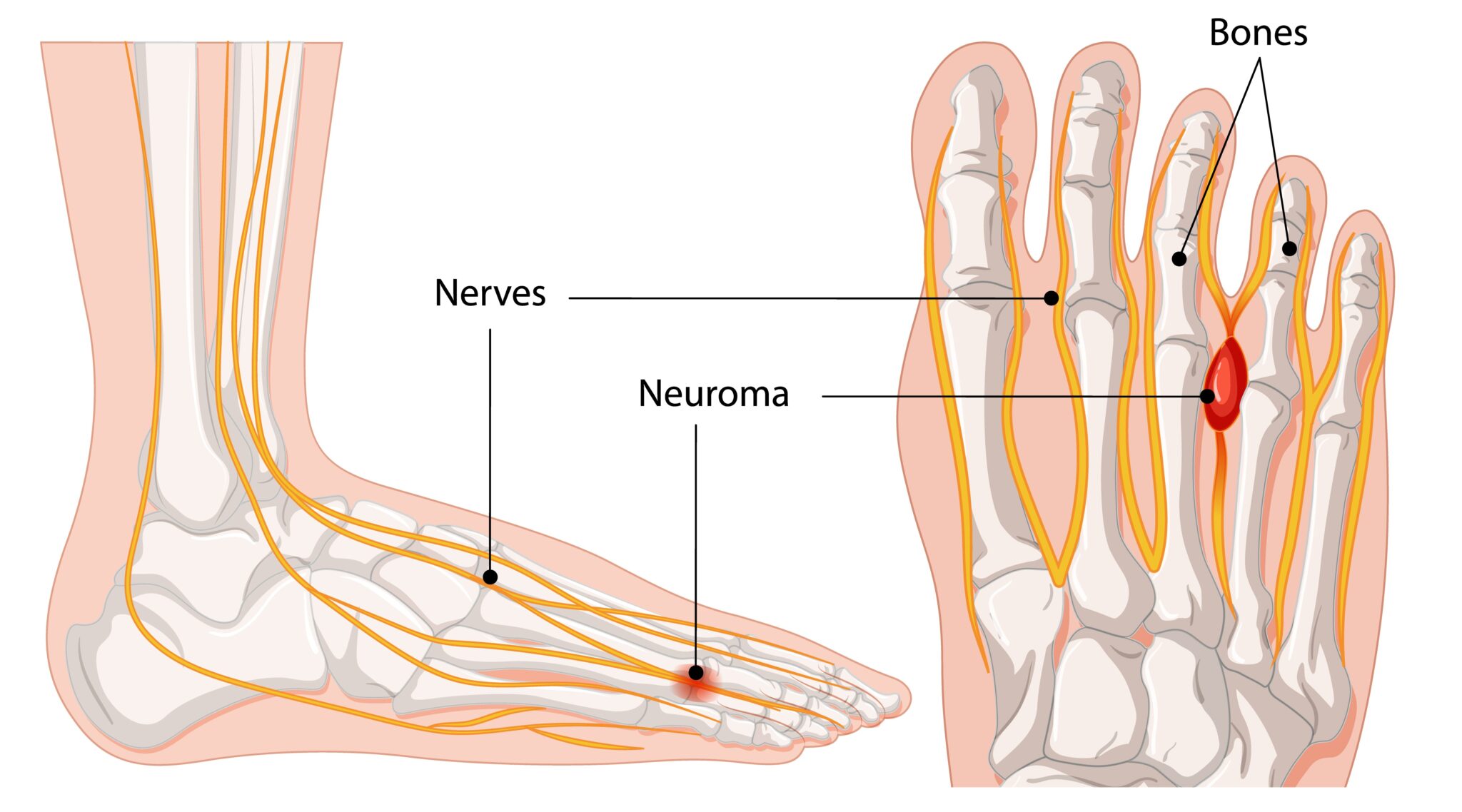 foot6