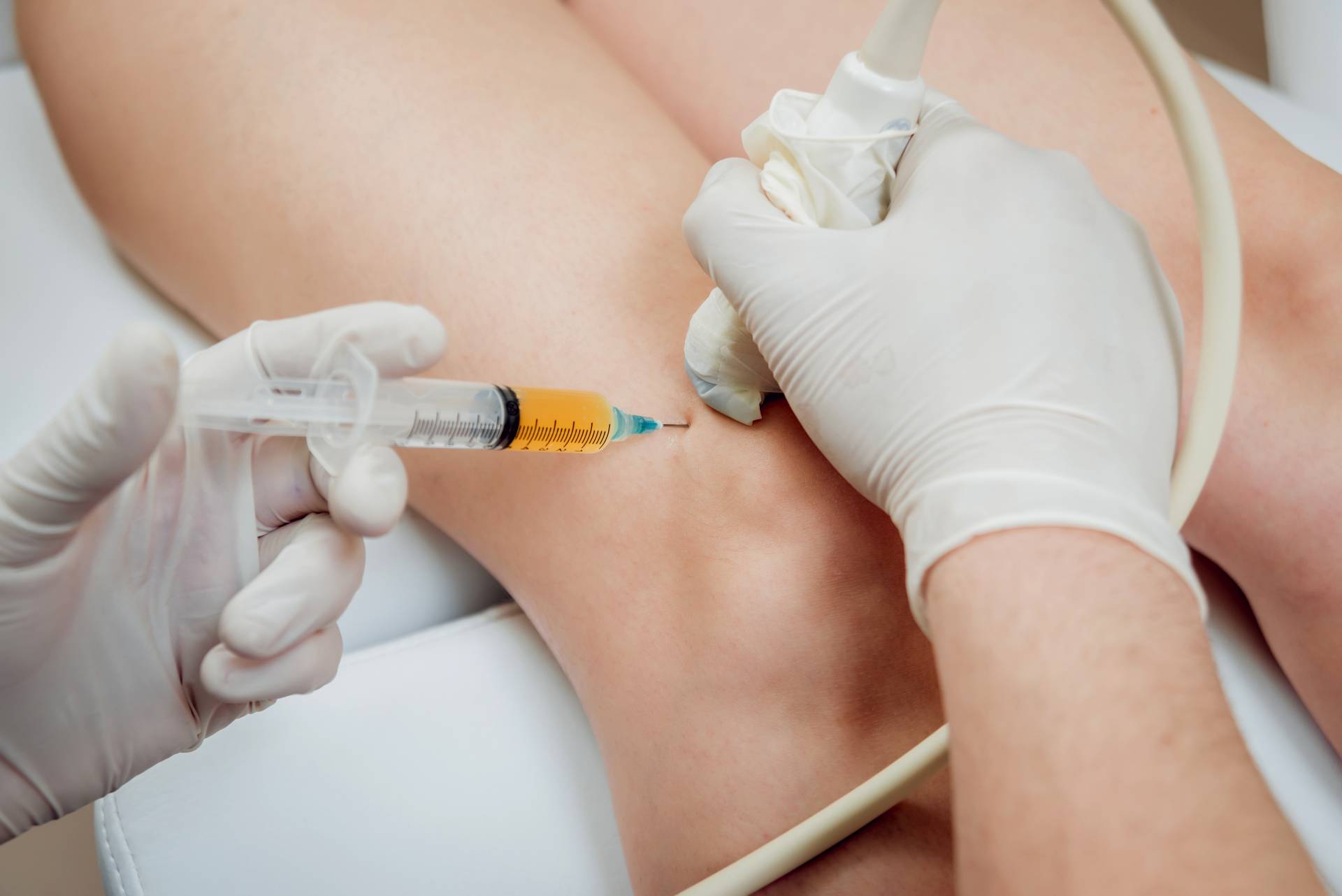 Ultrasound-guided hyaluronic acid injection provided in London