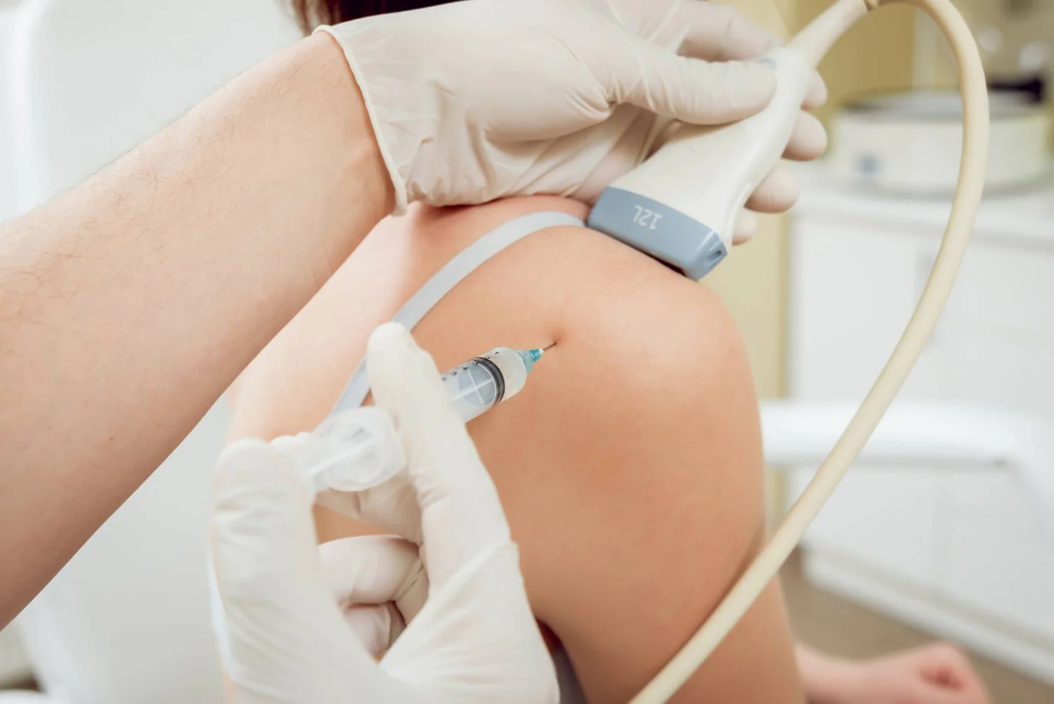 Hydrodilatation for Frozen Shoulder in London