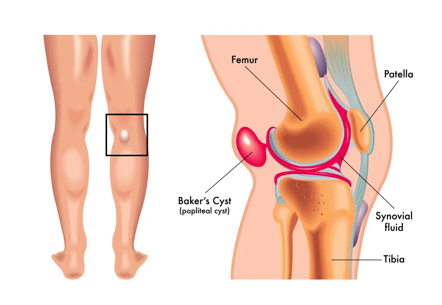 knee