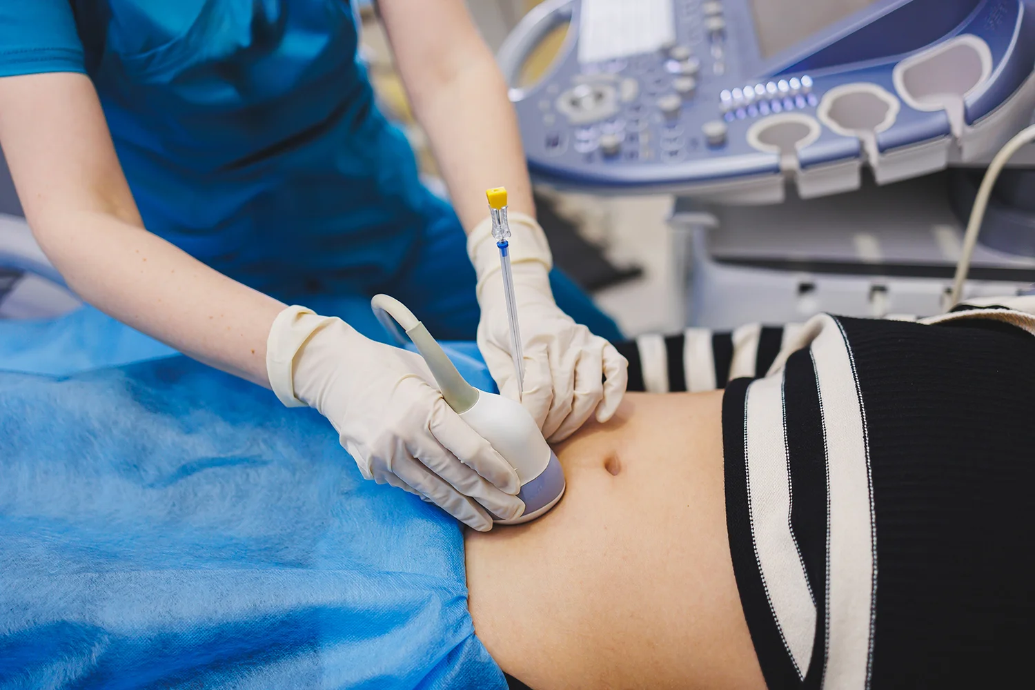 shot of a pregnant woman during an ultrasound scan