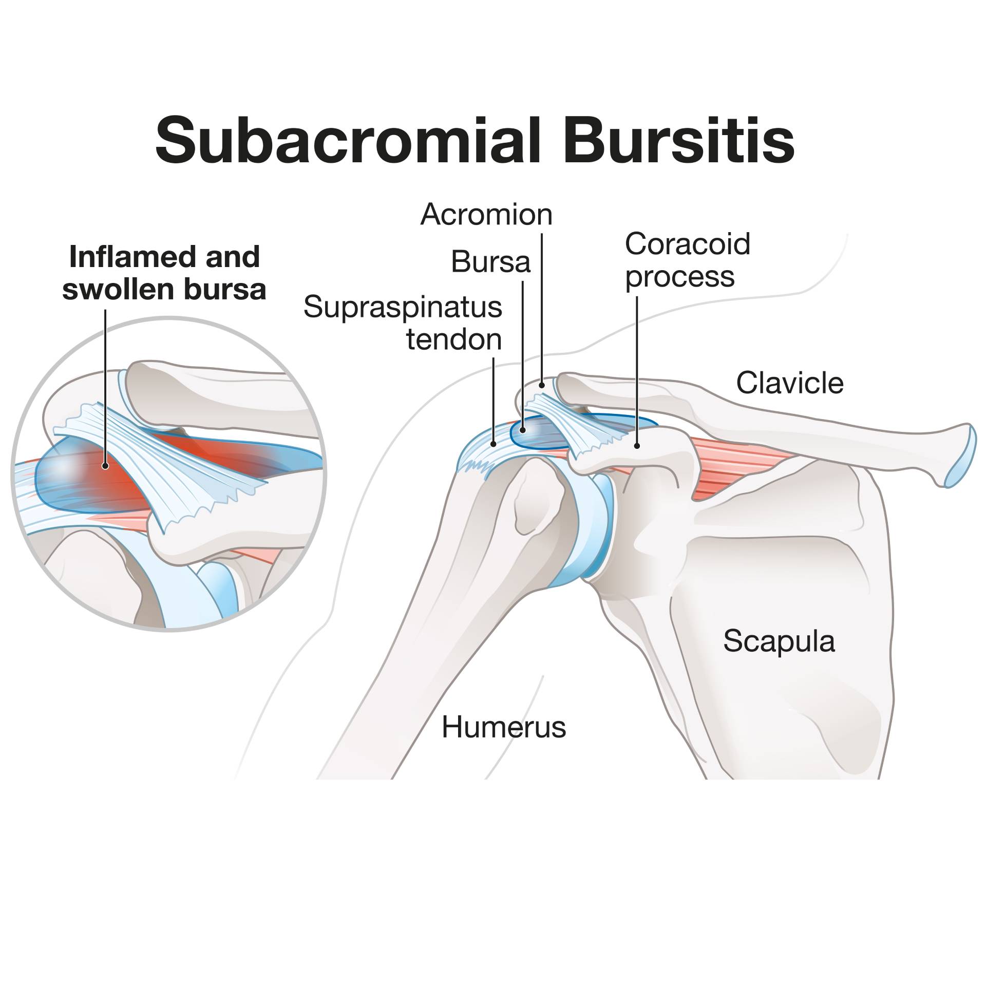 shoulderbursa