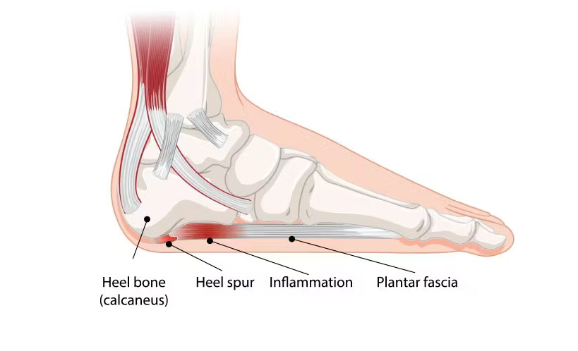 foot2